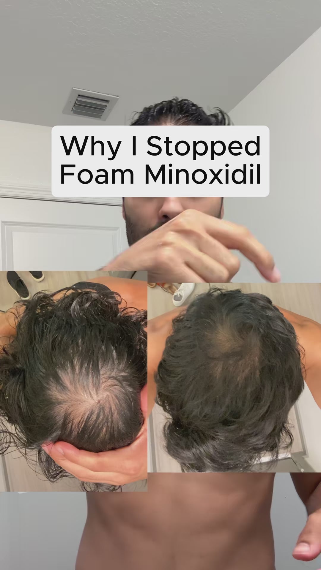 5% Extra Strength Hair Regrowth video