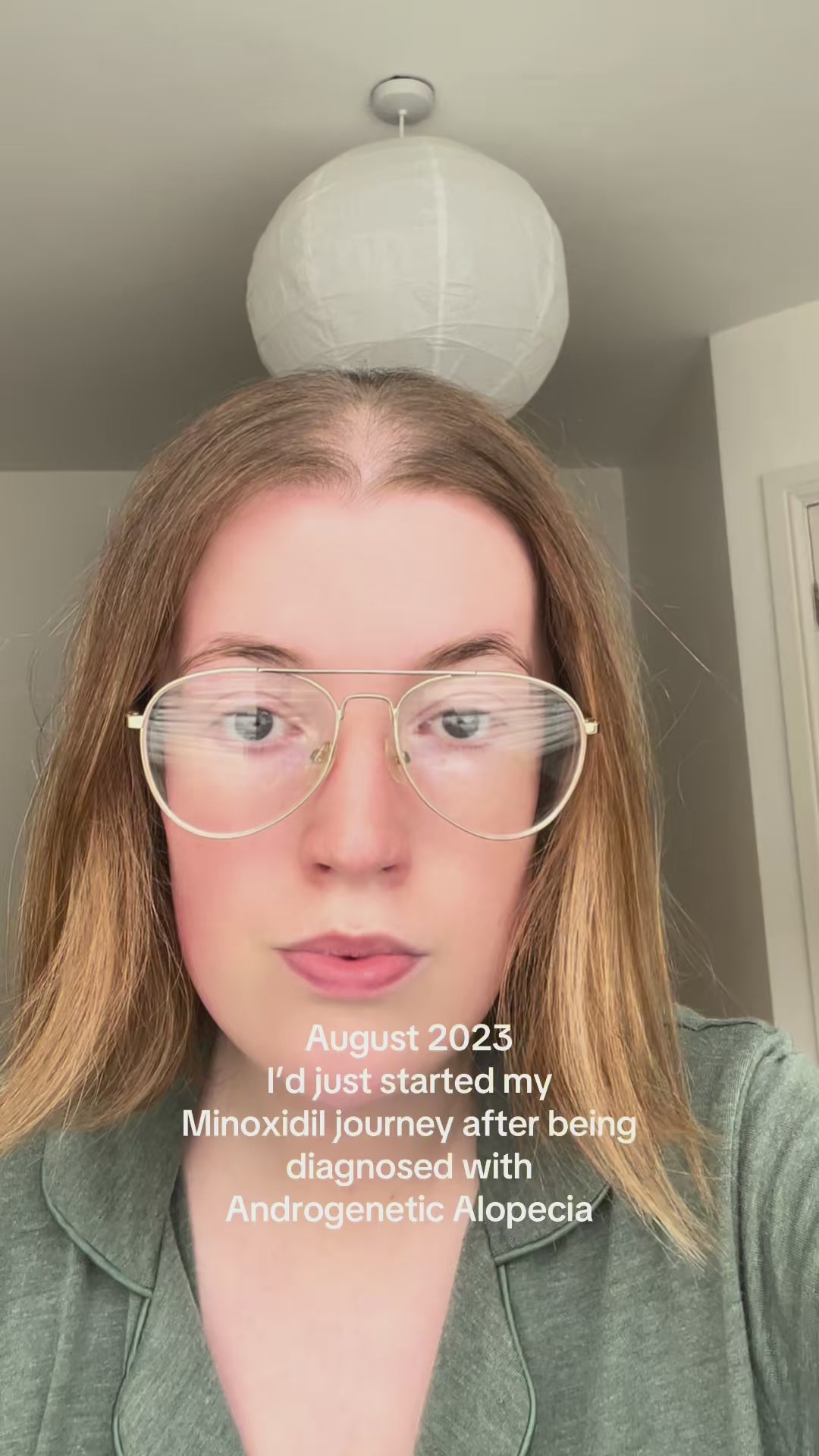 5% Extra Strength Hair Regrowth video