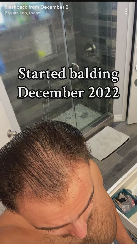 5% Extra Strength Hair Regrowth video