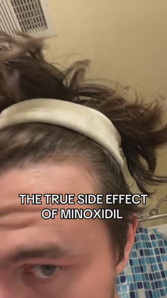 5% Extra Strength Hair Regrowth video