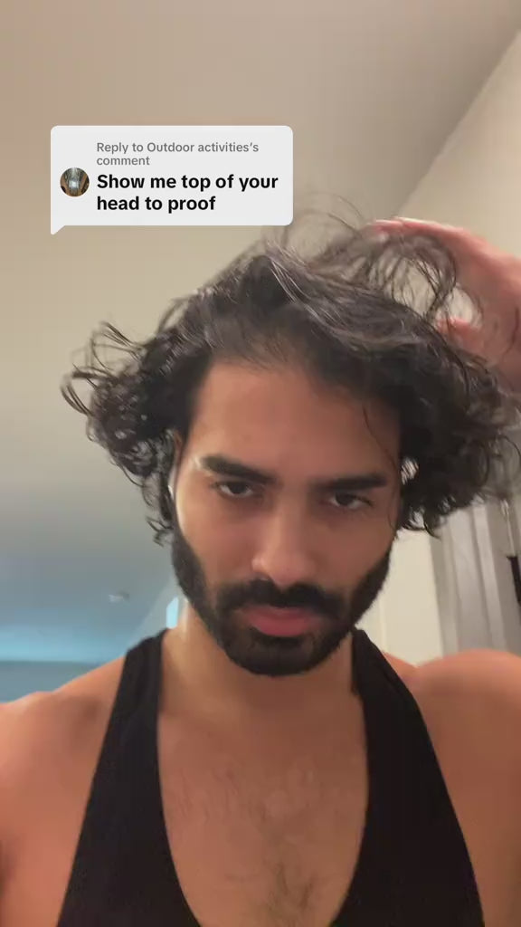 5% Extra Strength Hair Regrowth video