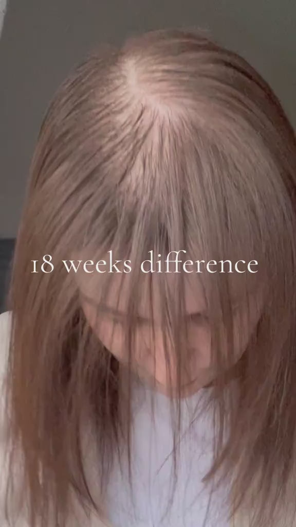5% Extra Strength Hair Regrowth video
