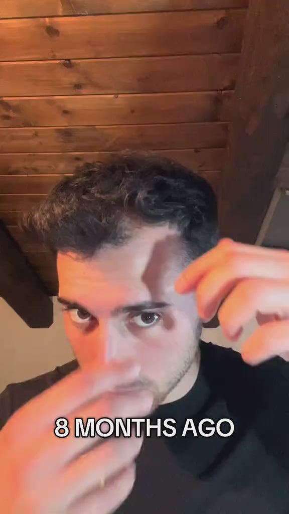 5% Extra Strength Hair Regrowth video